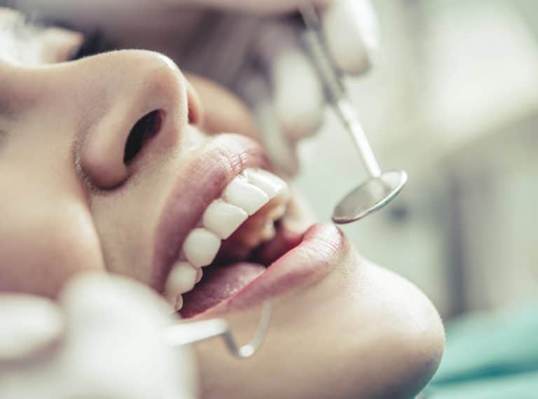 Composite Veneers vs. Porcelain Veneers: Which Type of Veneer Is Right for You?