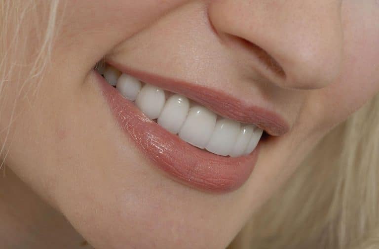 Are Porcelain Veneers Really Stain-Resistant
